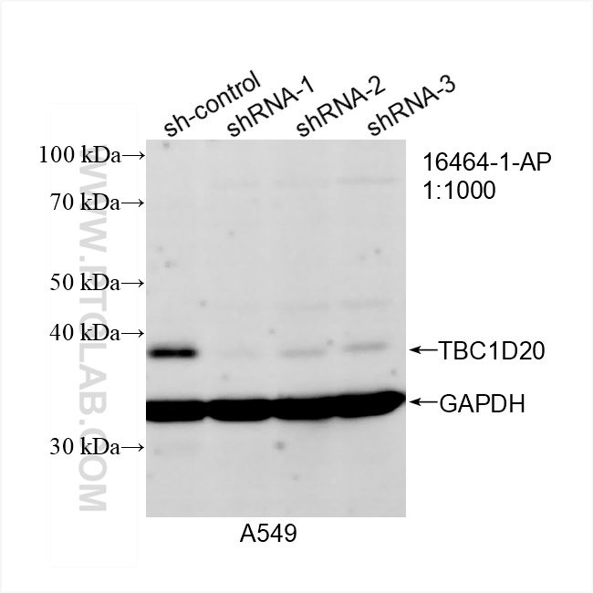 Western Blot (WB) analysis of A549 cells using TBC1D20 Polyclonal antibody (16464-1-AP)