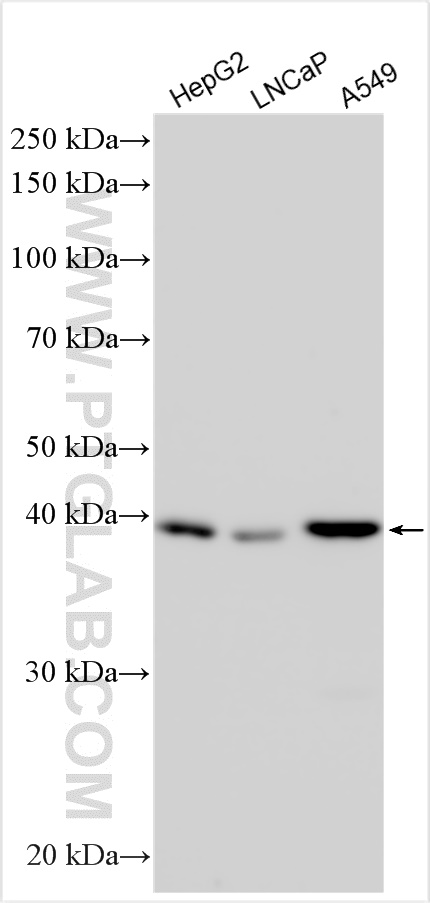 Western Blot (WB) analysis of various lysates using TBC1D20 Polyclonal antibody (16464-1-AP)