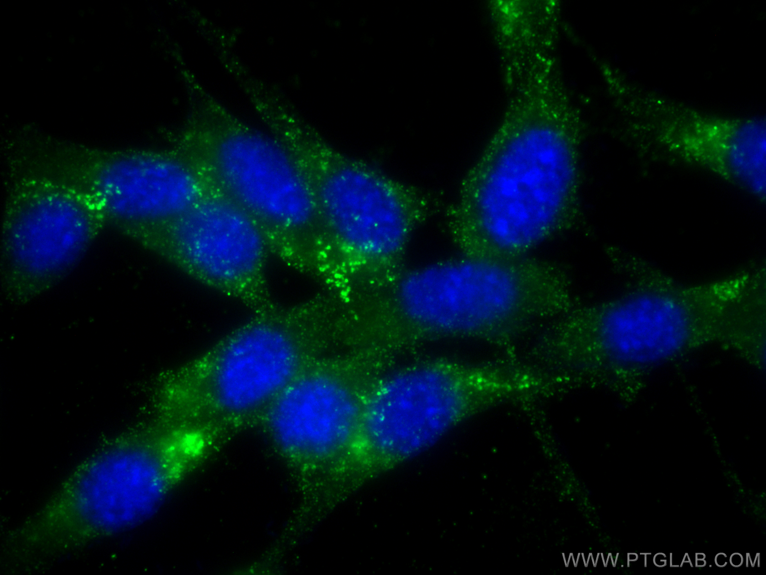 Immunofluorescence (IF) / fluorescent staining of NIH/3T3 cells using TBC1D25 Monoclonal antibody (67574-1-Ig)