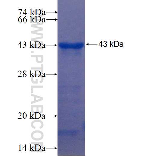 TBC1D9 fusion protein Ag22457 SDS-PAGE