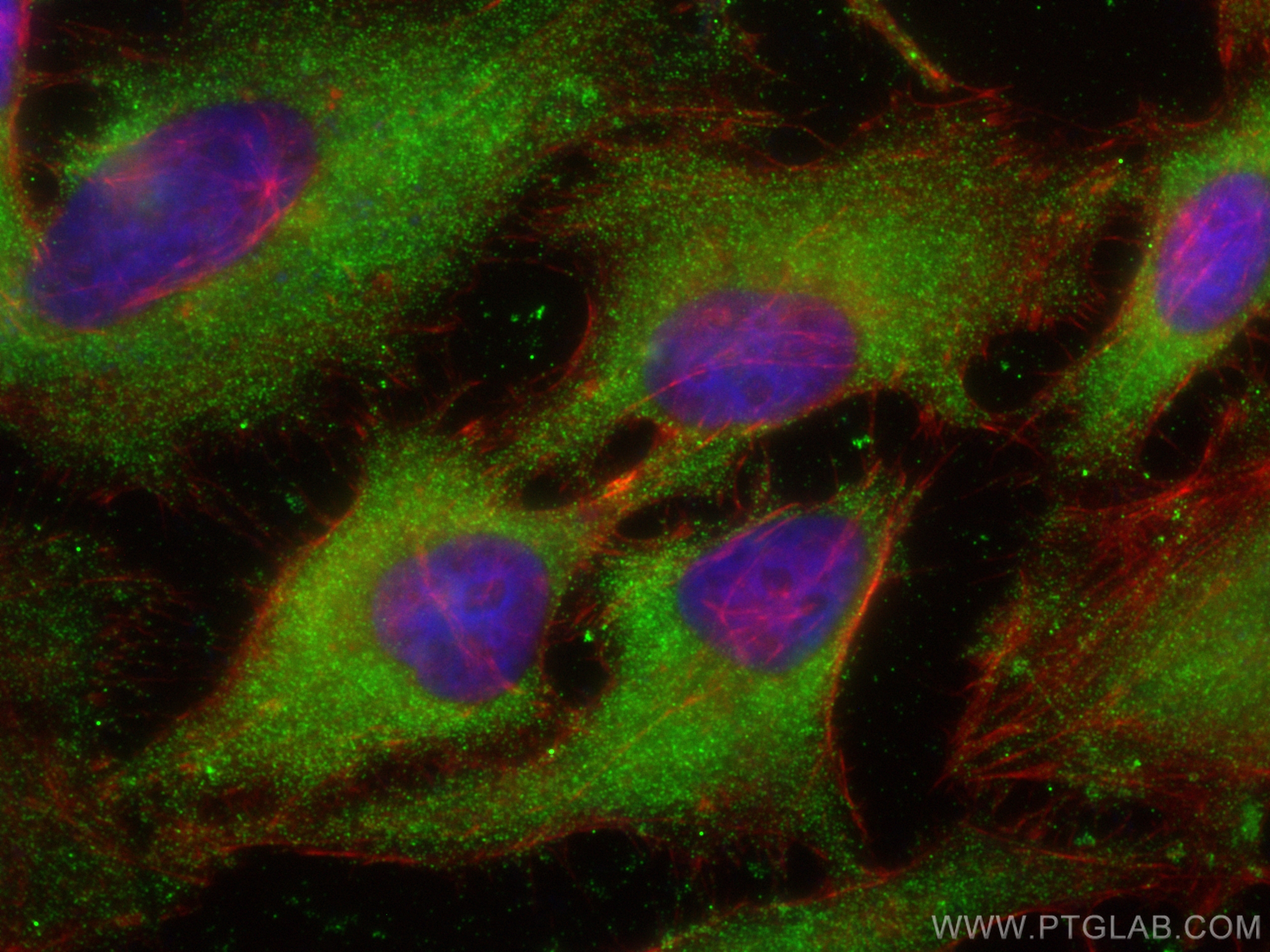 Immunofluorescence (IF) / fluorescent staining of HeLa cells using TBCC Monoclonal antibody (68371-1-Ig)