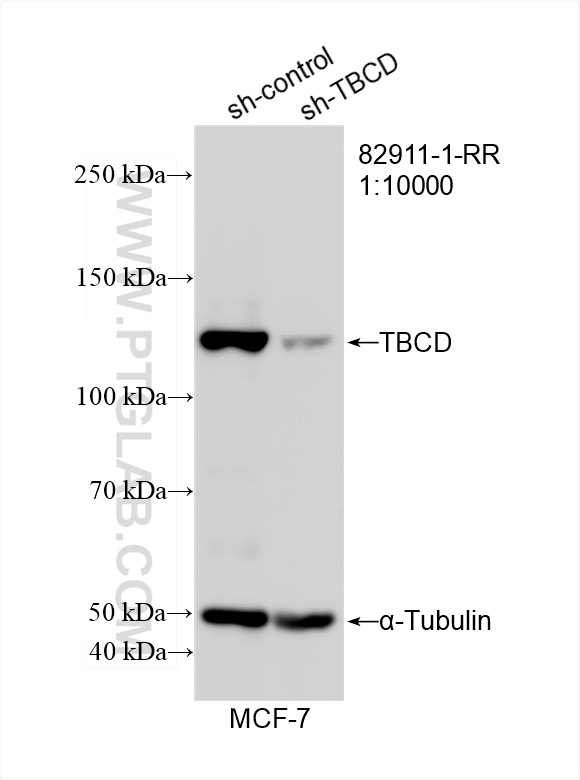 Western Blot (WB) analysis of MCF-7 cells using TBCD Recombinant antibody (82911-1-RR)