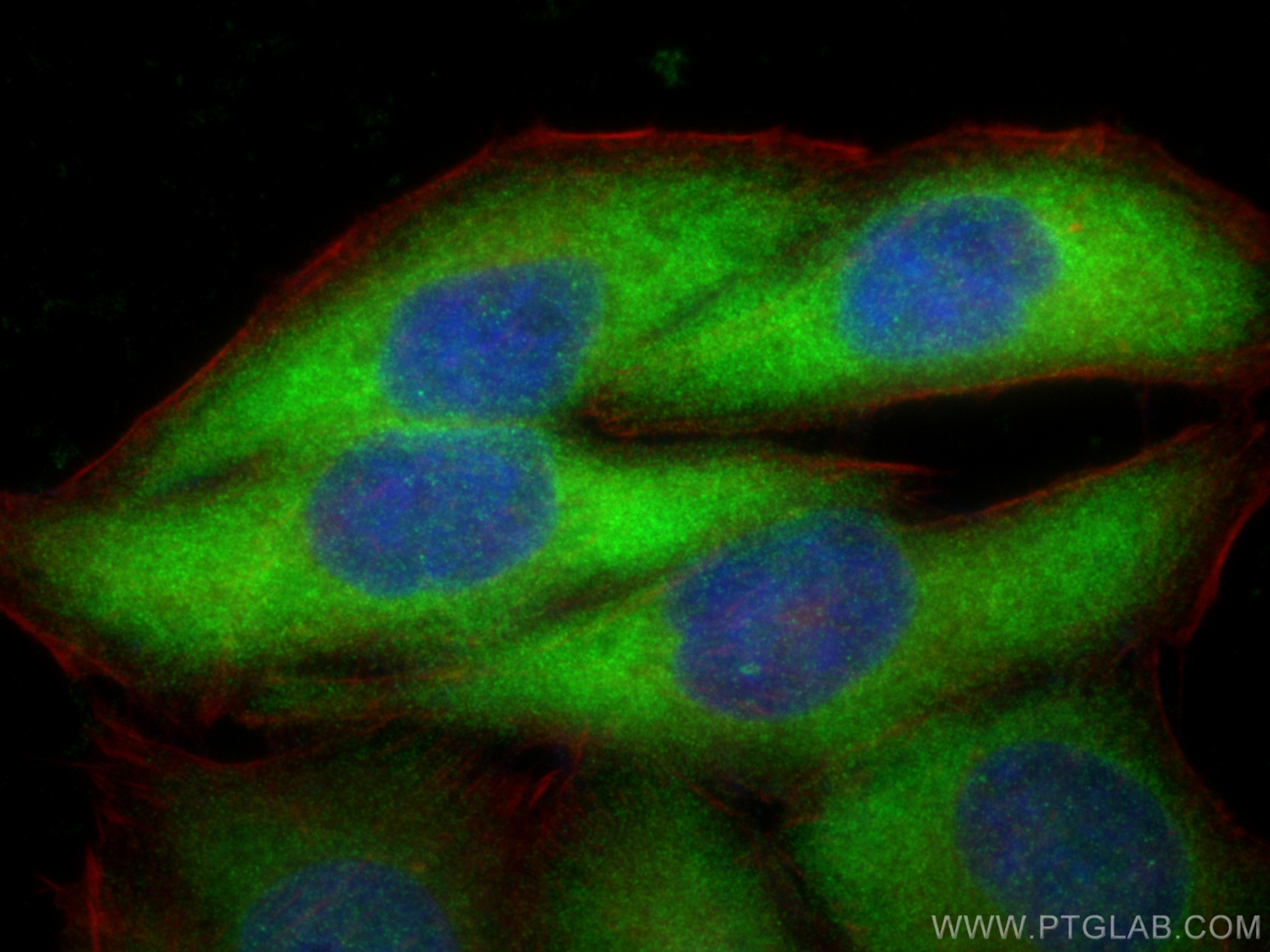 Immunofluorescence (IF) / fluorescent staining of HepG2 cells using TBCD Recombinant antibody (82911-7-RR)