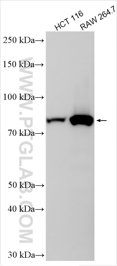 Western Blot (WB) analysis of various lysates using TBK1 Recombinant antibody (83686-3-RR)