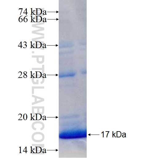 TBK1 fusion protein Ag24665 SDS-PAGE