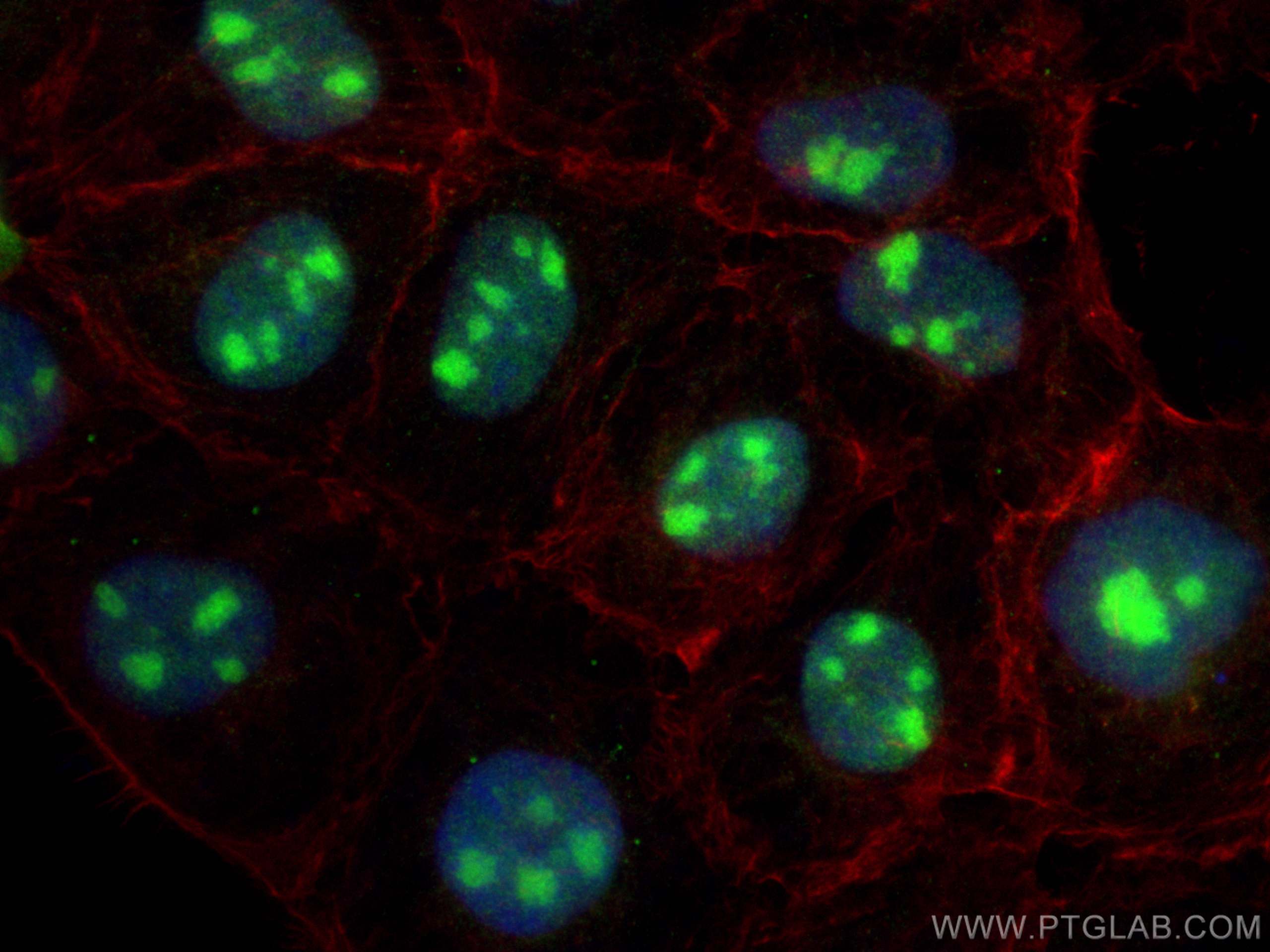 Immunofluorescence (IF) / fluorescent staining of A431 cells using TBL3 Polyclonal antibody (31150-1-AP)