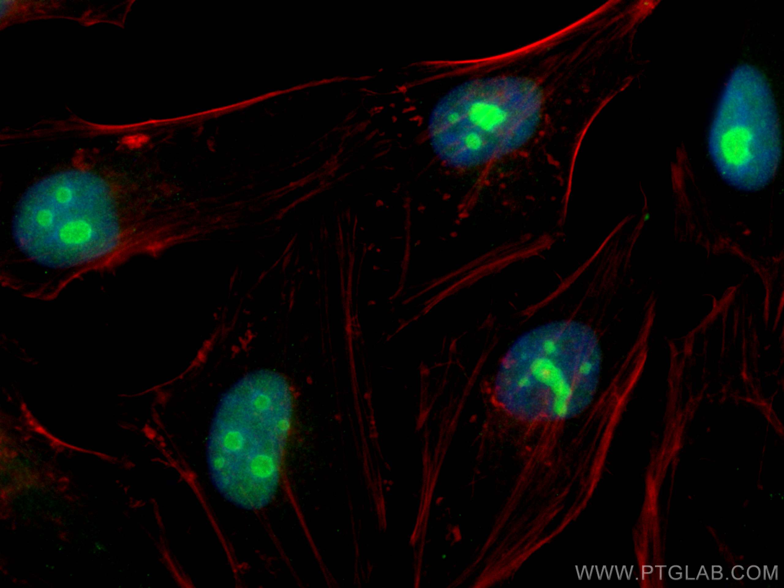 Immunofluorescence (IF) / fluorescent staining of HeLa cells using TBL3 Polyclonal antibody (31150-1-AP)