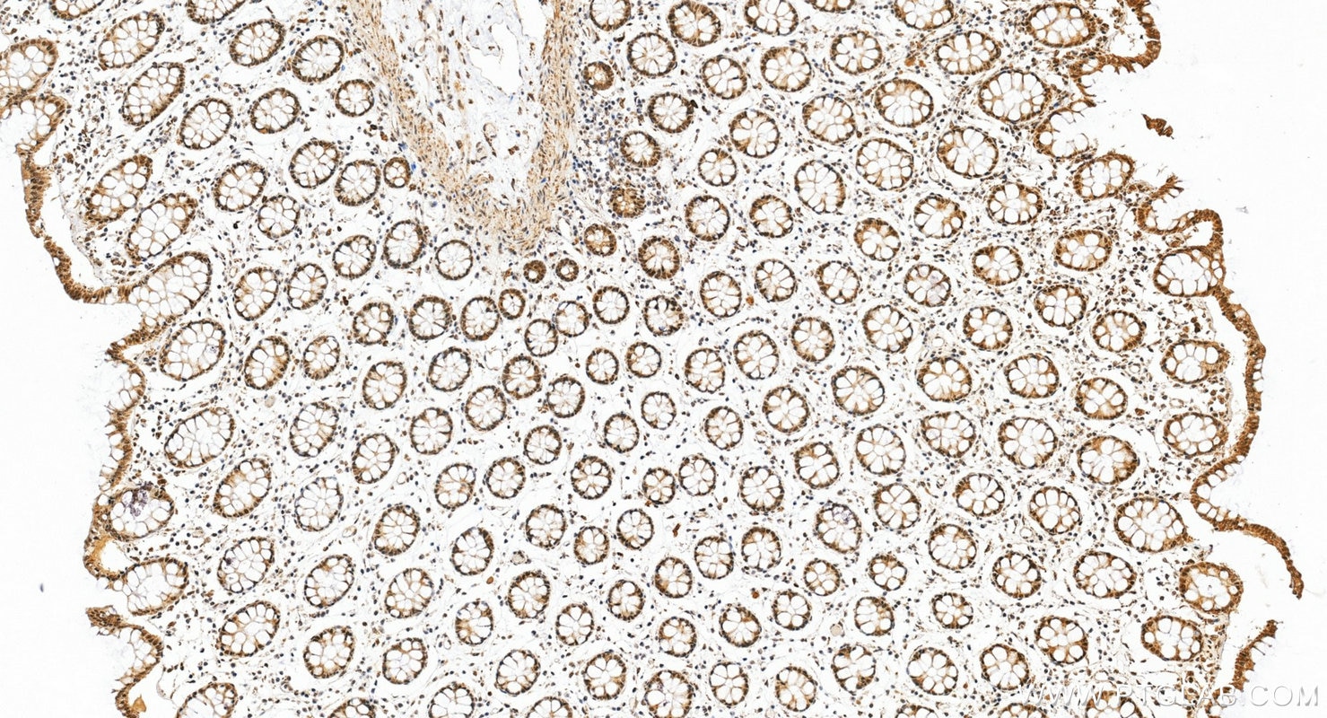 Immunohistochemistry (IHC) staining of human colon tissue using TBP Polyclonal antibody (22006-1-AP)