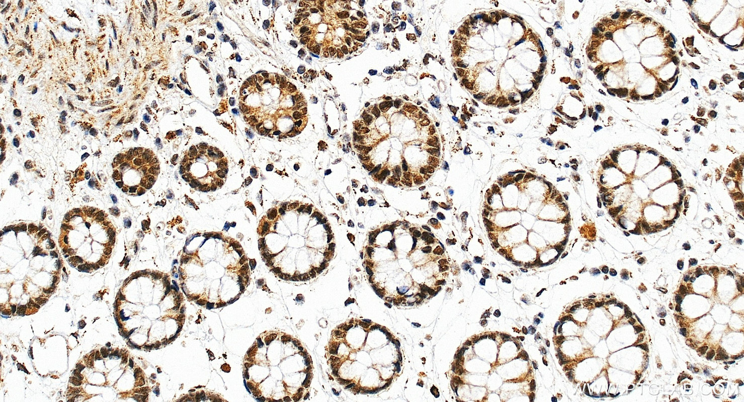 Immunohistochemistry (IHC) staining of human colon tissue using TBP Polyclonal antibody (22006-1-AP)