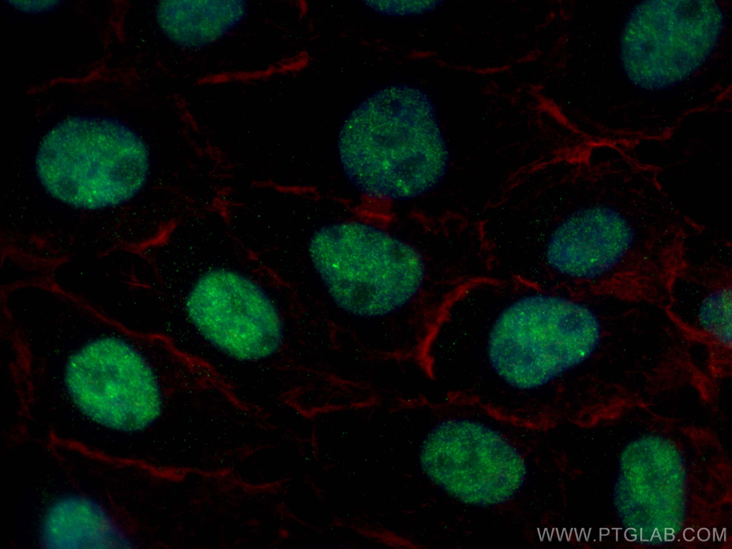 Immunofluorescence (IF) / fluorescent staining of A431 cells using TBP Monoclonal antibody (66166-1-Ig)