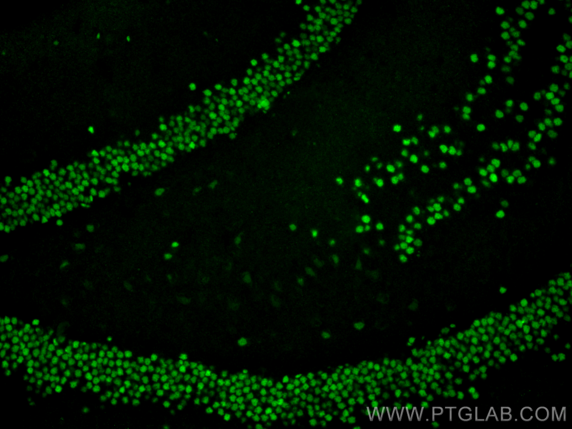 Immunofluorescence (IF) / fluorescent staining of mouse brain tissue using TBR1 Polyclonal antibody (20932-1-AP)