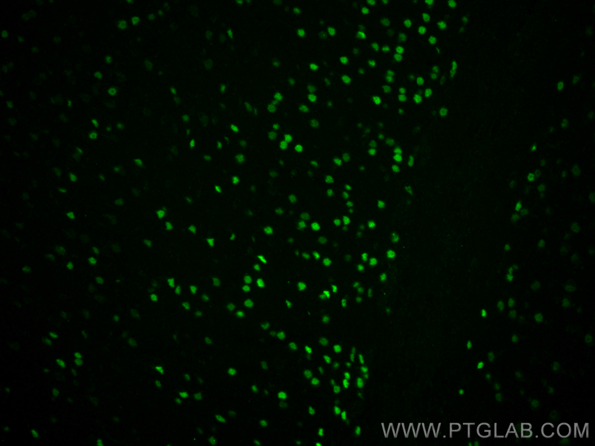 Immunofluorescence (IF) / fluorescent staining of mouse brain tissue using TBR1 Monoclonal antibody (66564-1-Ig)