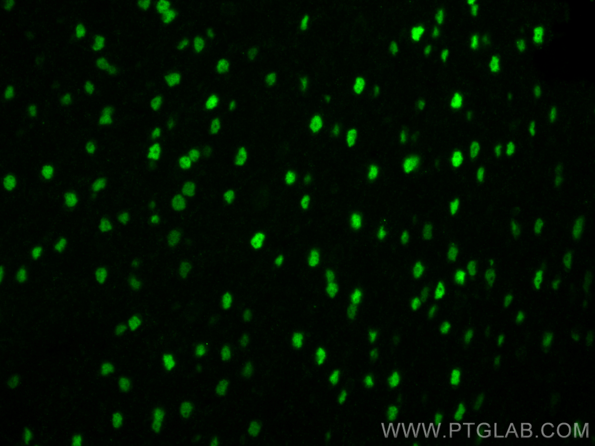 Immunofluorescence (IF) / fluorescent staining of mouse brain tissue using TBR1 Monoclonal antibody (66564-1-Ig)