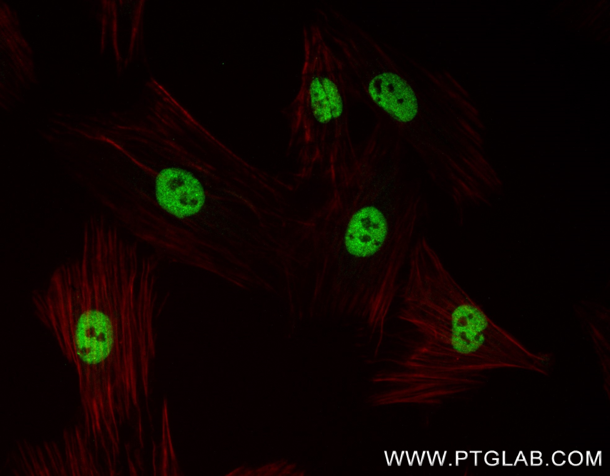 Immunofluorescence (IF) / fluorescent staining of H9C2 cells using TBX20 Recombinant antibody (83414-3-RR)