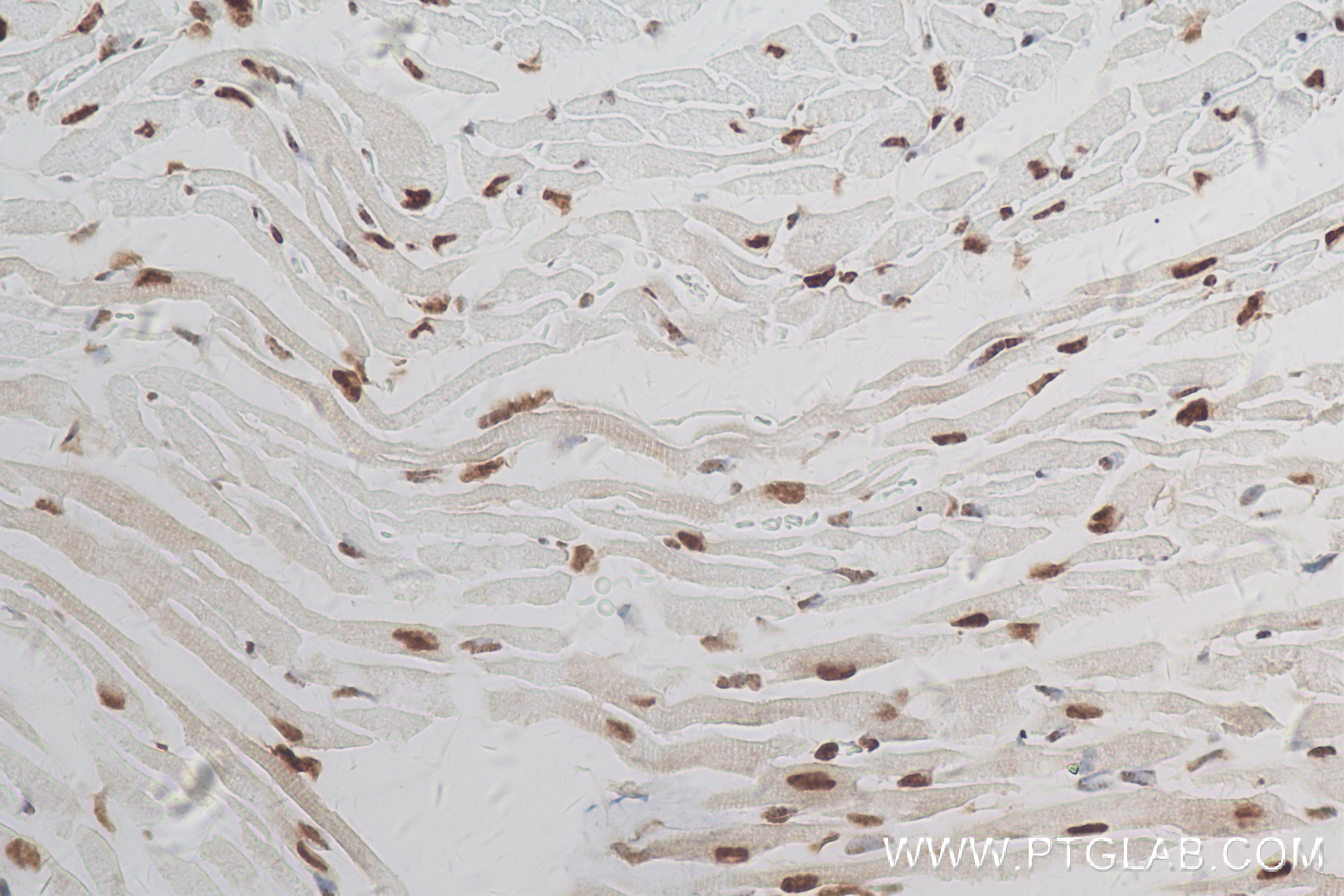 Immunohistochemistry (IHC) staining of mouse heart tissue using TBX20 Recombinant antibody (83414-3-RR)