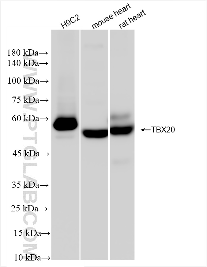 Western Blot (WB) analysis of various lysates using TBX20 Recombinant antibody (83414-5-RR)