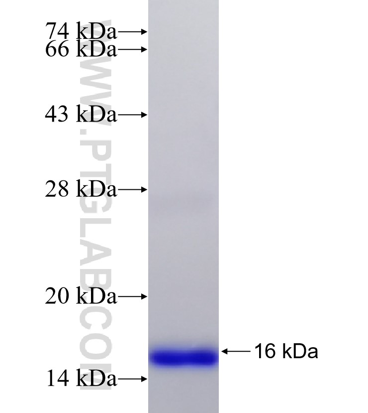 TBXAS1 fusion protein Ag30961 SDS-PAGE