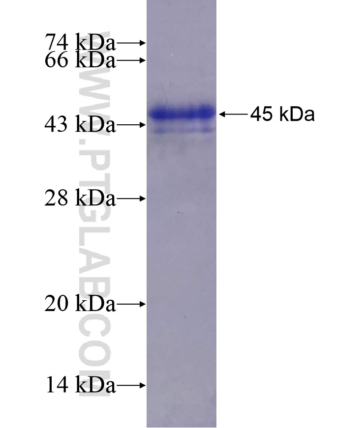 TCF21 fusion protein Ag27140 SDS-PAGE