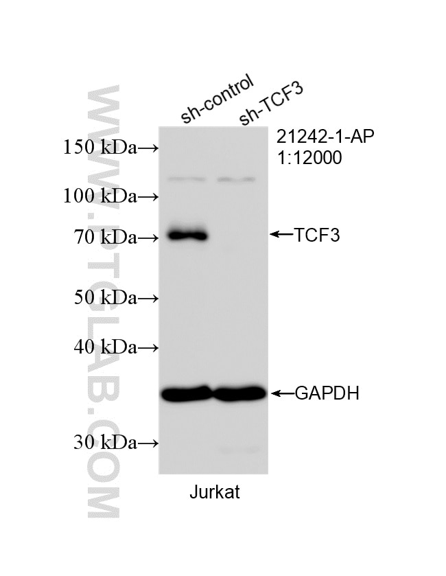 Western Blot (WB) analysis of Jurkat cells using TCF3 Polyclonal antibody (21242-1-AP)