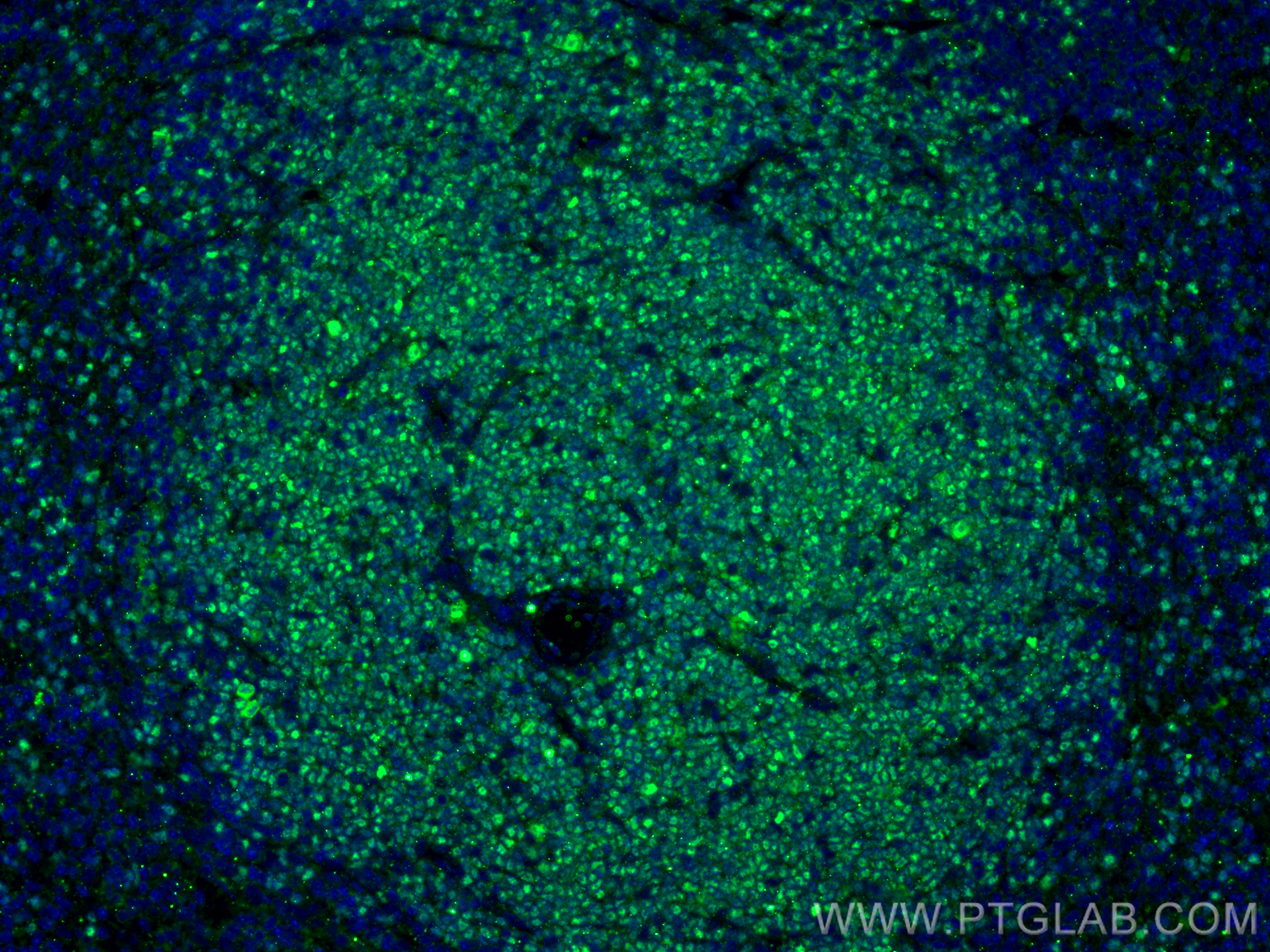 Immunofluorescence (IF) / fluorescent staining of mouse spleen tissue using TCF1/TCF7 Polyclonal antibody (14464-1-AP)