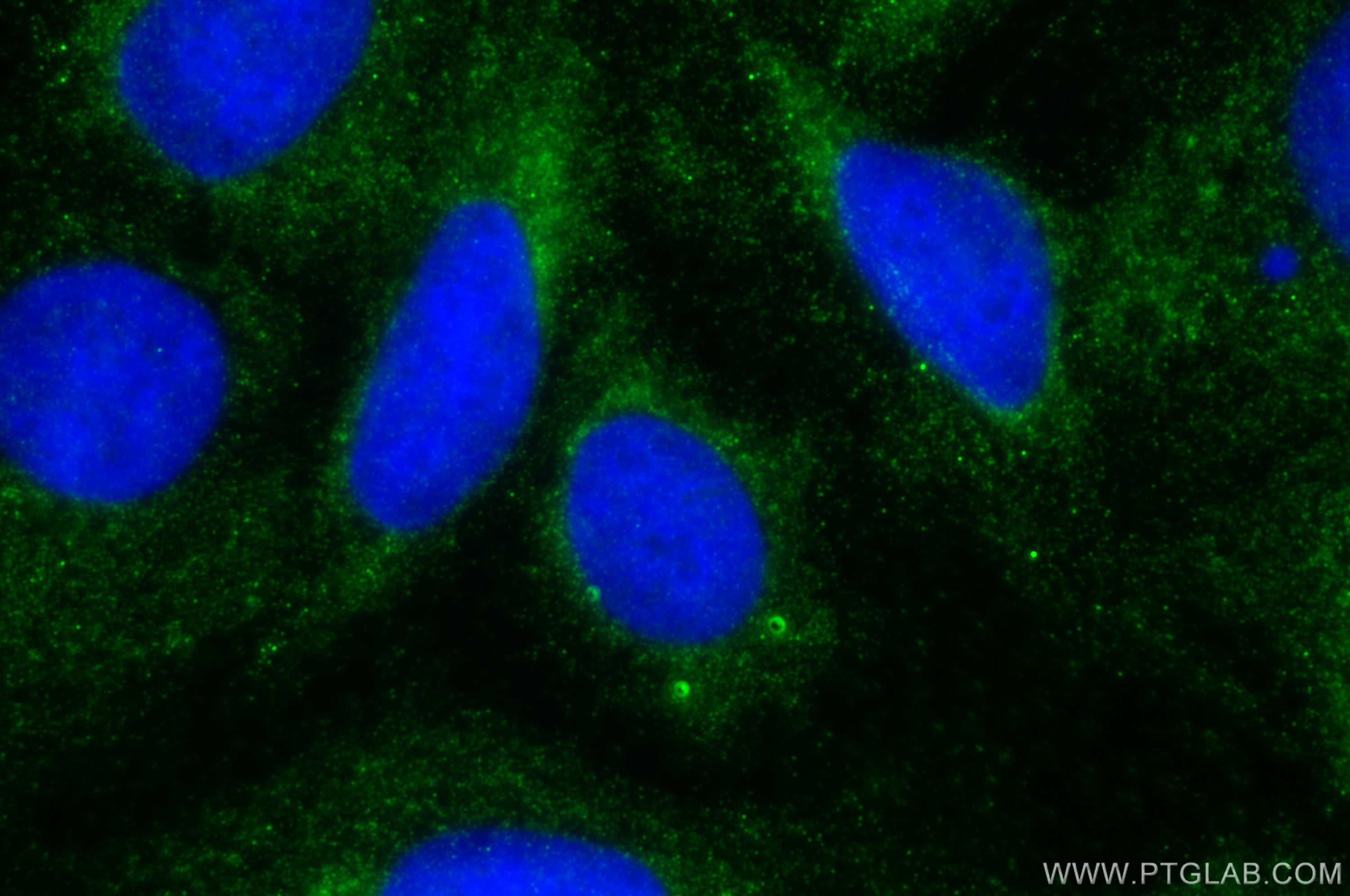 Immunofluorescence (IF) / fluorescent staining of U2OS cells using TCF7L1 Polyclonal antibody (14519-1-AP)