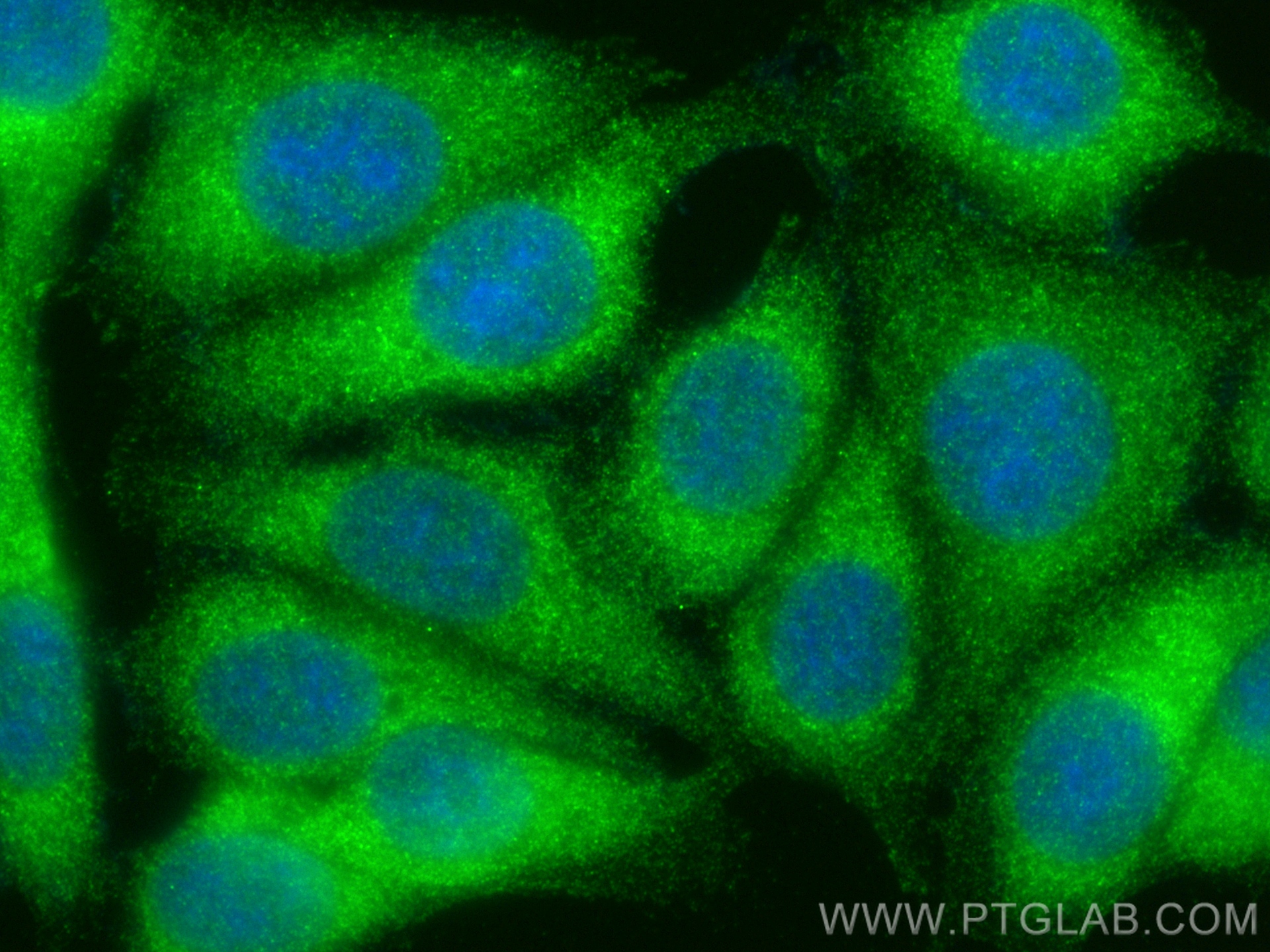 Immunofluorescence (IF) / fluorescent staining of MCF-7 cells using TCHP Polyclonal antibody (25931-1-AP)