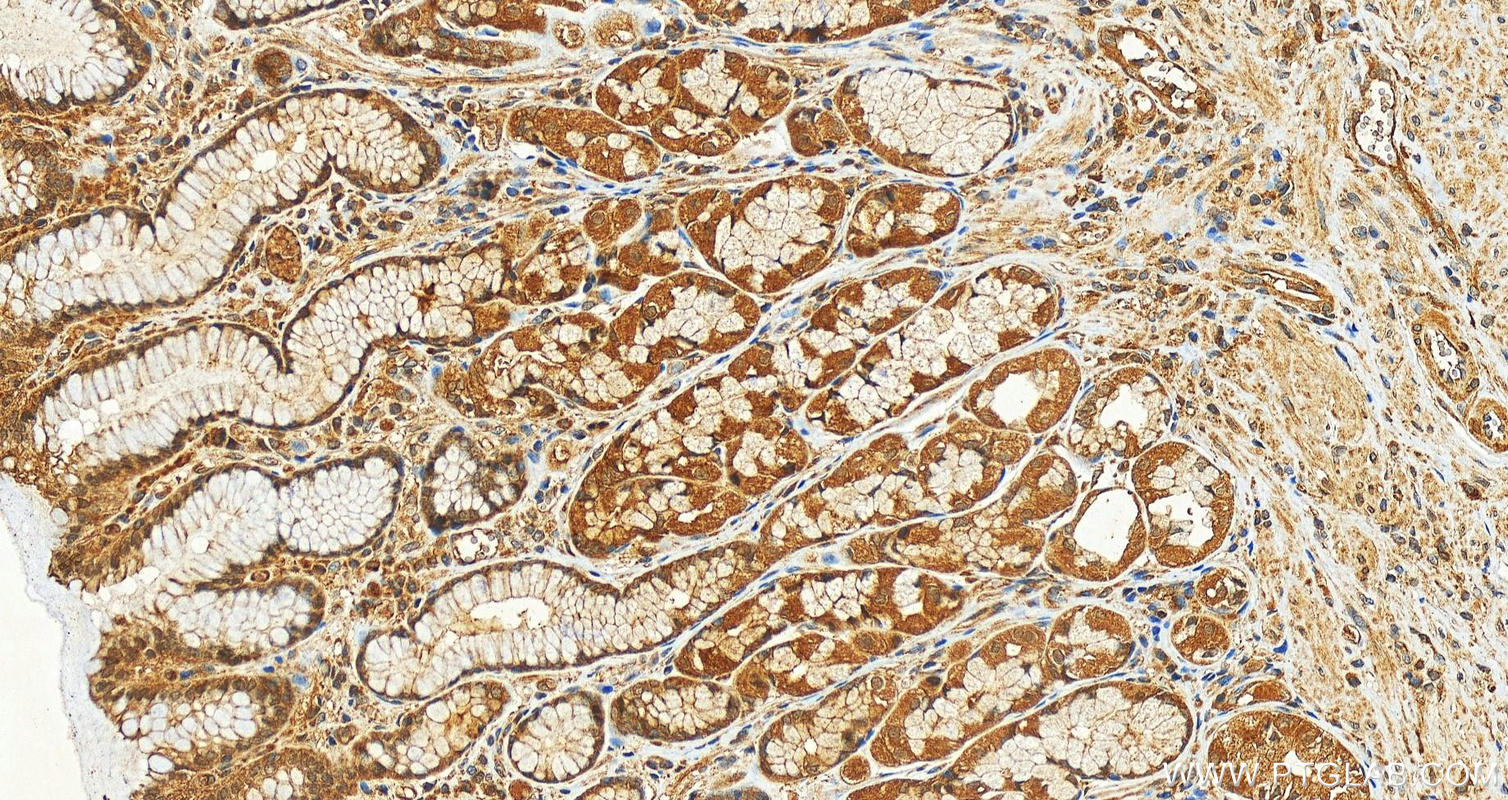 Immunohistochemistry (IHC) staining of human stomach tissue using TCIRG1 Polyclonal antibody (12649-1-AP)