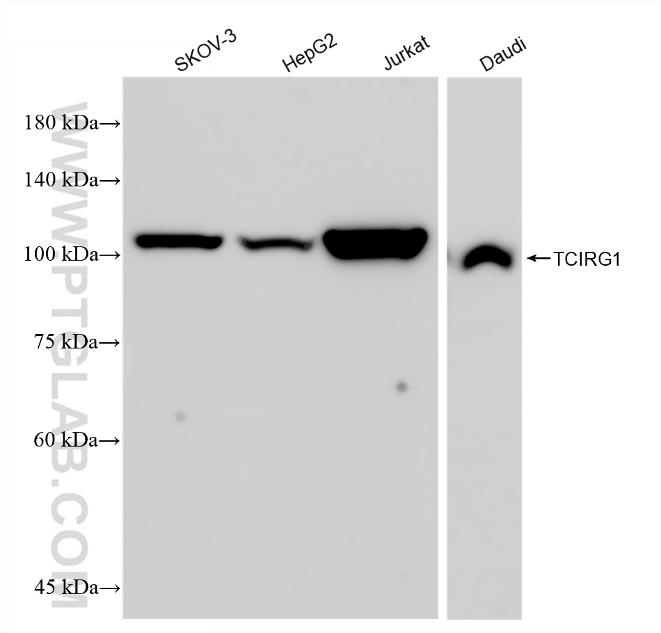 Western Blot (WB) analysis of various lysates using TCIRG1 Recombinant antibody (83351-6-RR)