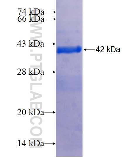 TCTEX1D2 fusion protein Ag25770 SDS-PAGE