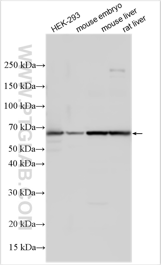 Western Blot (WB) analysis of various lysates using TCTN3 Polyclonal antibody (16085-1-AP)