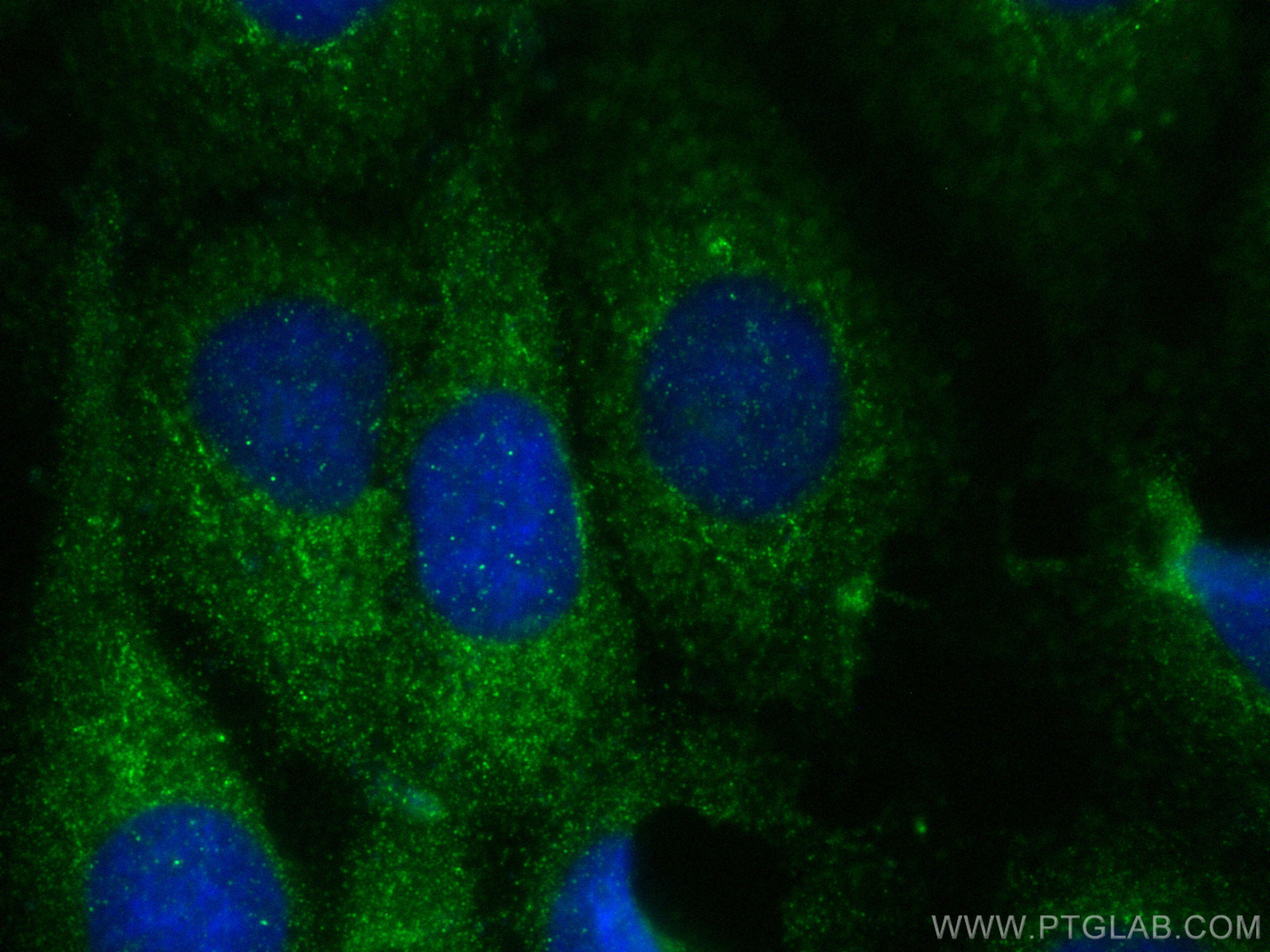 Immunofluorescence (IF) / fluorescent staining of A431 cells using TDO2 Polyclonal antibody (15880-1-AP)