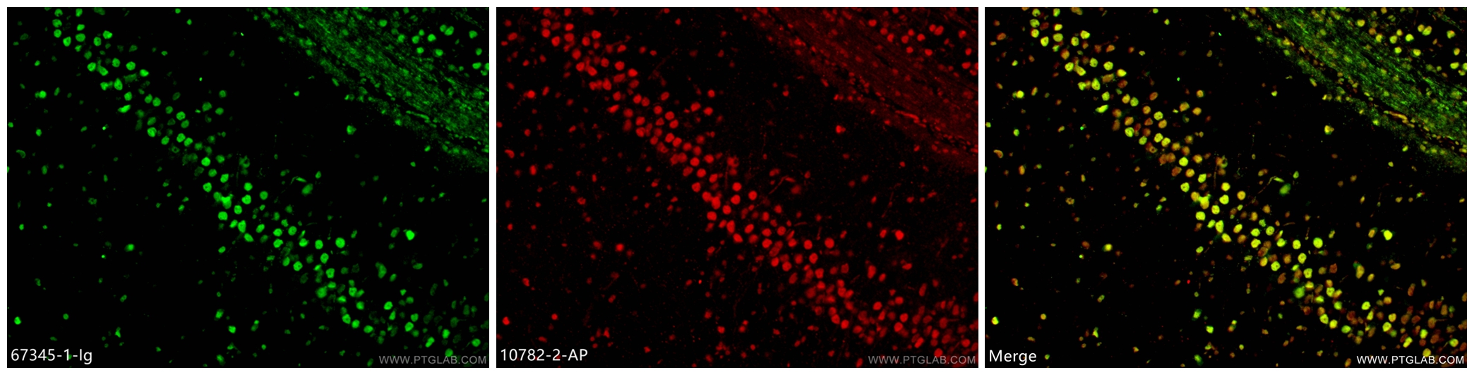 Immunofluorescence (IF) / fluorescent staining of rat brain tissue using TDP-43 (C-terminal) Monoclonal antibody (67345-1-Ig)