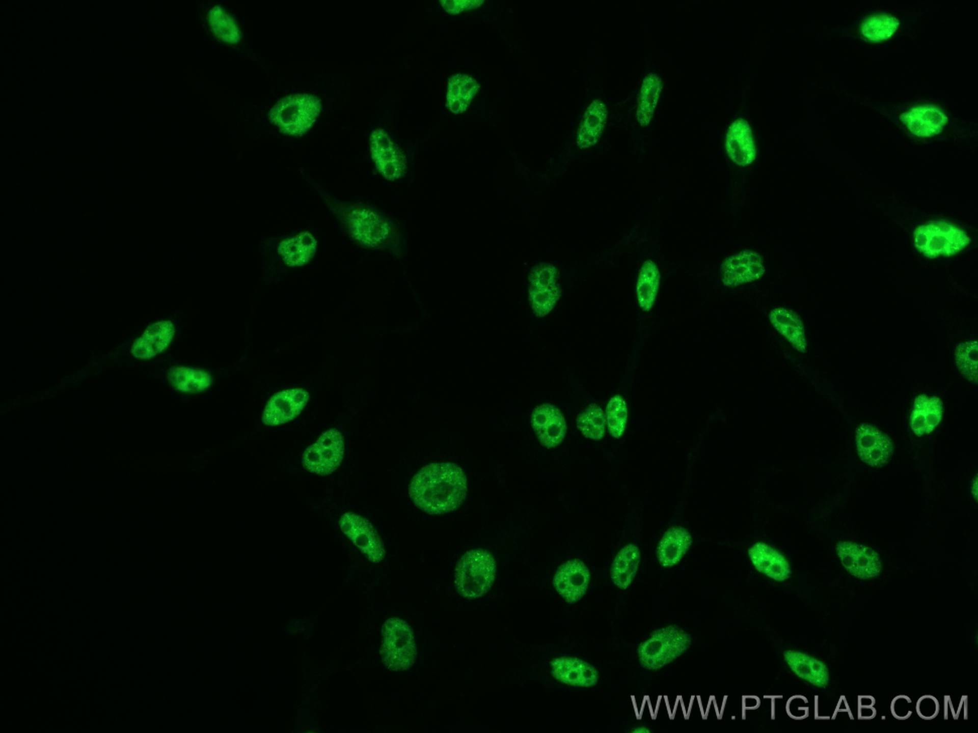 Immunofluorescence (IF) / fluorescent staining of HeLa cells using CoraLite® Plus 488-conjugated TDP-43 (for IF/FC) R (CL488-80002)