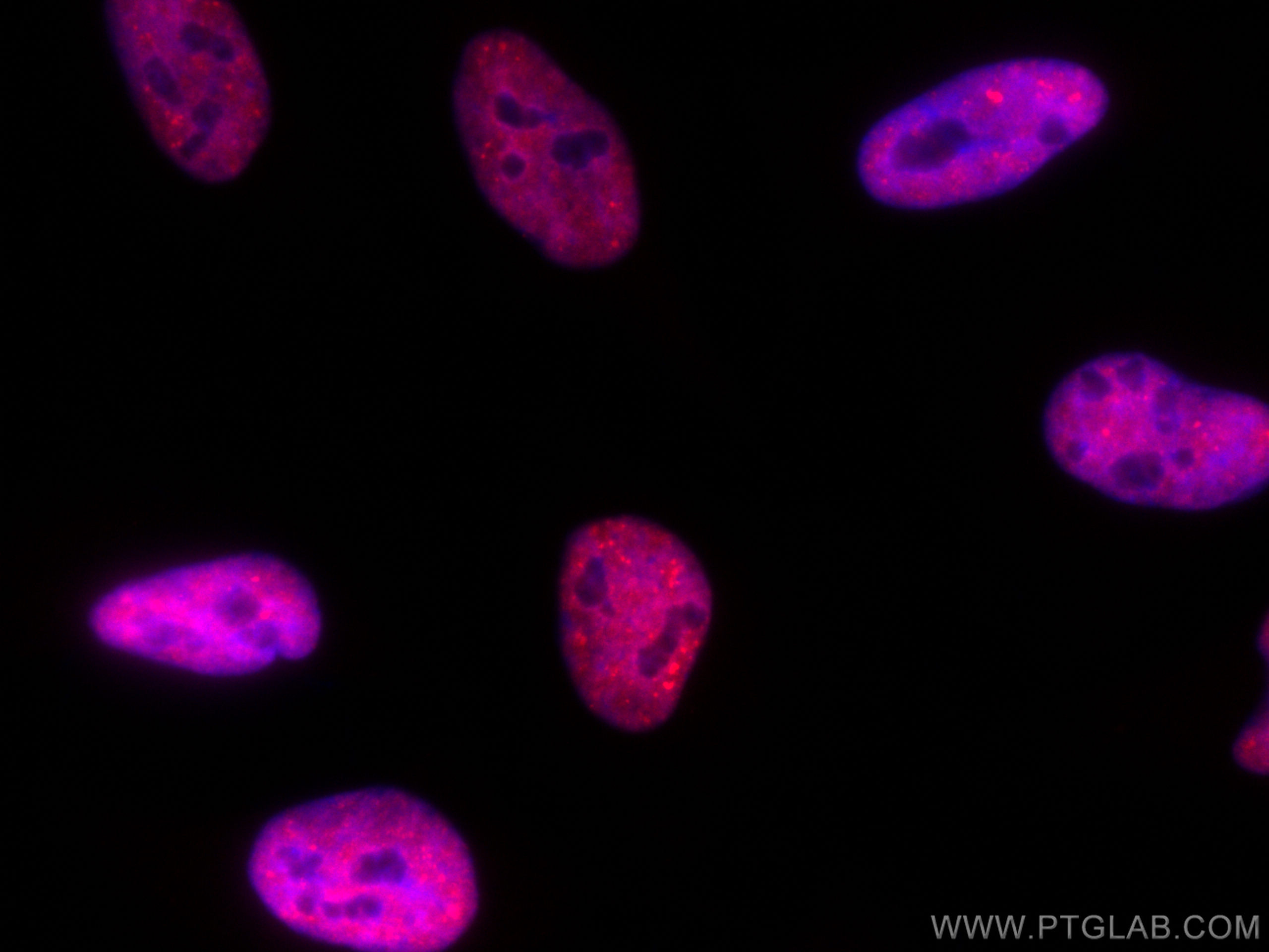 Immunofluorescence (IF) / fluorescent staining of HeLa cells using CoraLite®594-conjugated TDP-43 (for IF/FC) Recombi (CL594-80002)
