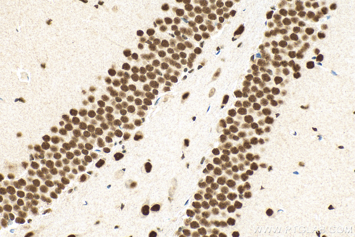 Immunohistochemistry (IHC) staining of mouse brain tissue using TDP-43 Monoclonal antibody (66734-1-Ig)