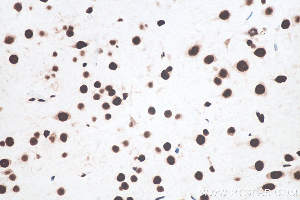 Immunohistochemistry (IHC) staining of rat brain tissue using TDP-43 (N-terminal) Recombinant monoclonal antibod (80001-1-RR)