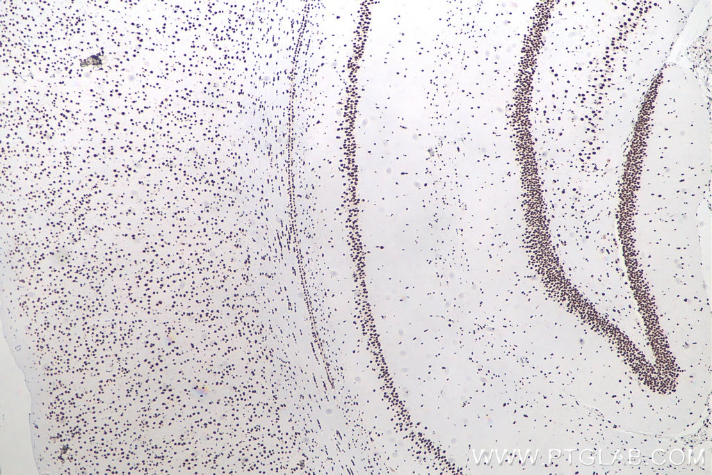 Immunohistochemistry (IHC) staining of rat brain tissue using TDP-43 (N-terminal) Recombinant monoclonal antibod (80001-1-RR)