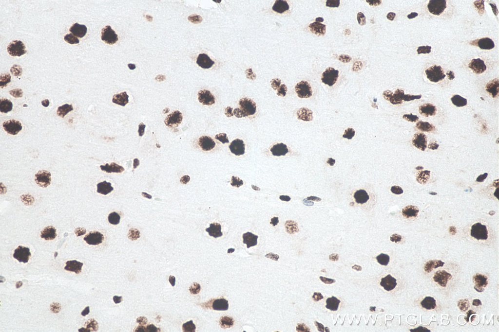 Immunohistochemistry (IHC) staining of human brain tissue using TDP-43 (N-terminal) Recombinant monoclonal antibod (80001-1-RR)