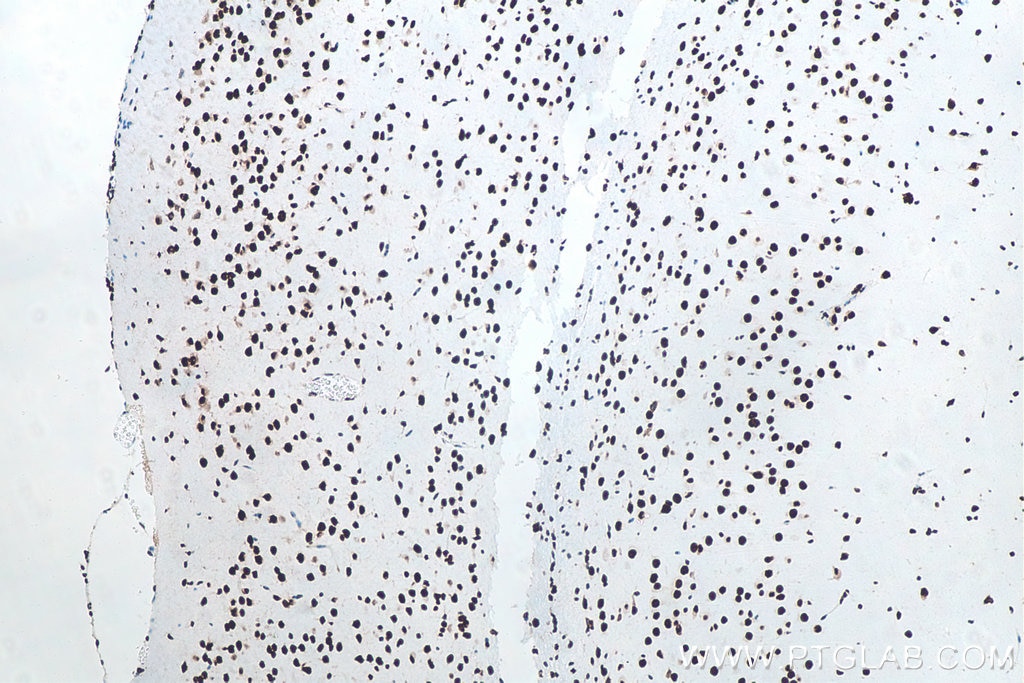 Immunohistochemistry (IHC) staining of mouse brain tissue using TDP-43 (N-terminal) Recombinant monoclonal antibod (80001-1-RR)