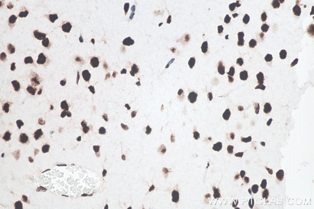 Immunohistochemistry (IHC) staining of mouse brain tissue using TDP-43 (N-terminal) Recombinant monoclonal antibod (80001-1-RR)