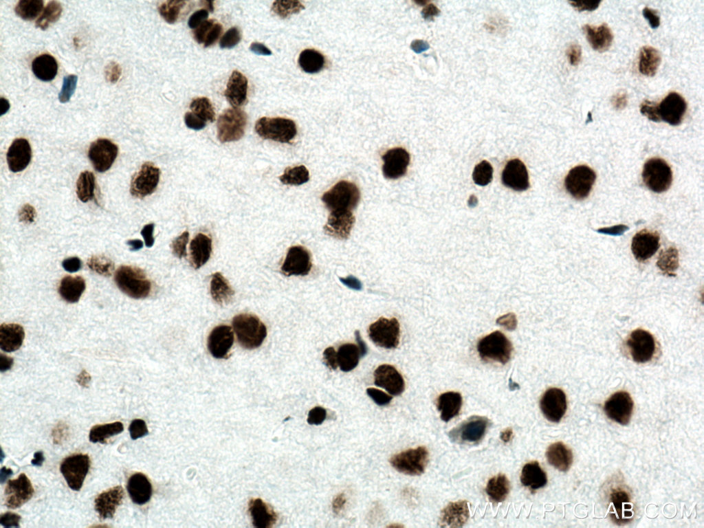 Immunohistochemistry (IHC) staining of mouse brain tissue using TDP-43 (N-terminal) Recombinant antibody (80002-1-RR)