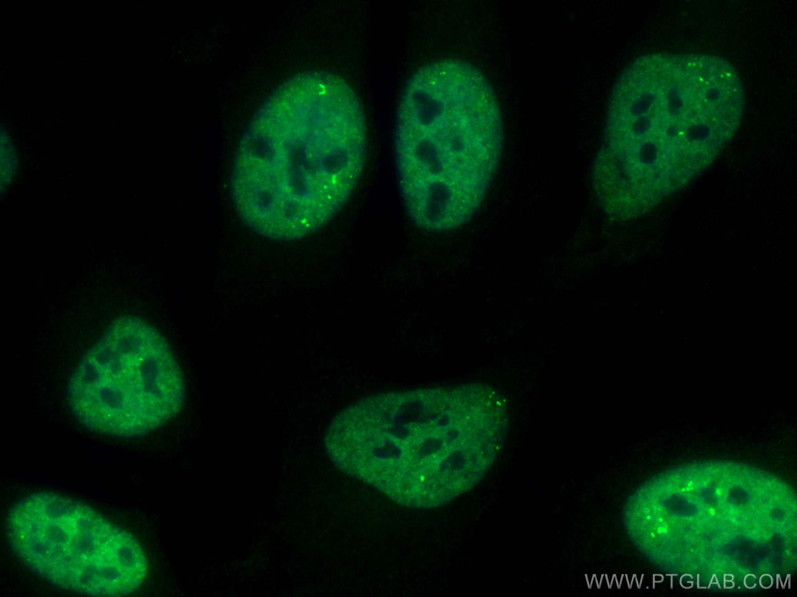 Immunofluorescence (IF) / fluorescent staining of HeLa cells using CoraLite® Plus 488-conjugated TDP-43 (C-terminal)  (CL488-81350)