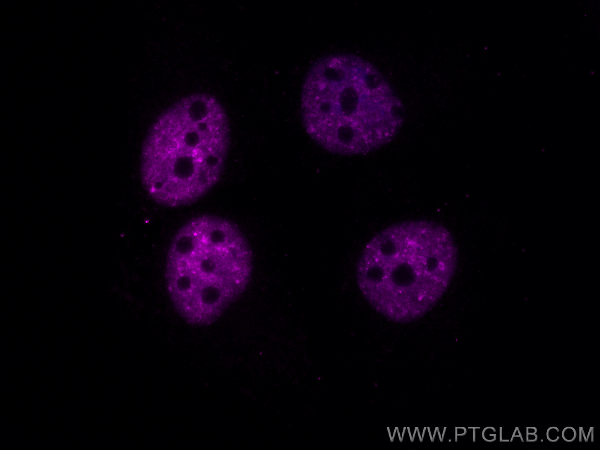 Immunofluorescence (IF) / fluorescent staining of HeLa cells using CoraLite® Plus 647-conjugated TDP-43 (C-terminal)  (CL647-67345)