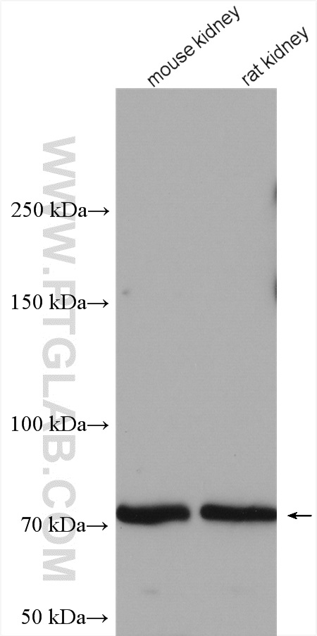 Western Blot (WB) analysis of various lysates using TEC Polyclonal antibody (18085-1-AP)