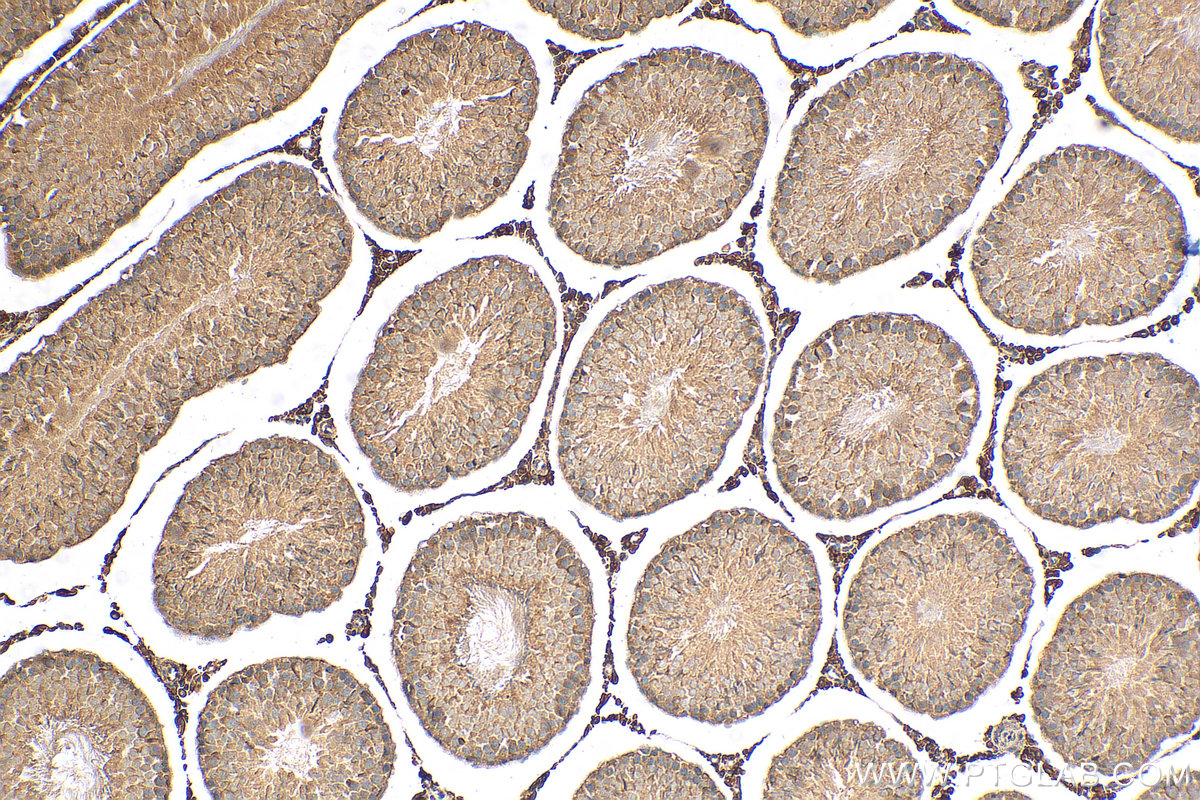 Immunohistochemistry (IHC) staining of rat testis tissue using TEKT5 Polyclonal antibody (26108-1-AP)