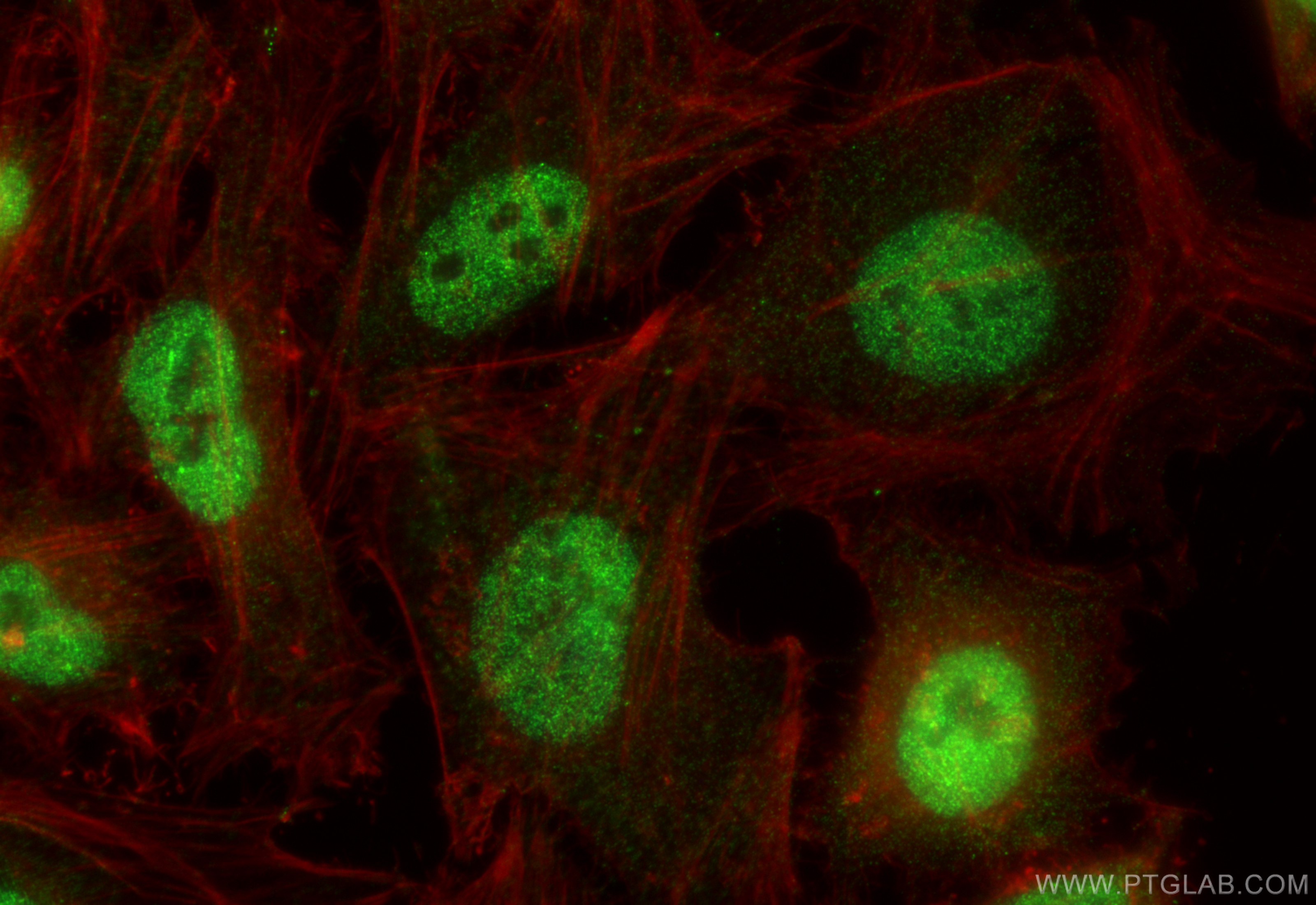 Immunofluorescence (IF) / fluorescent staining of HeLa cells using TET2 Polyclonal antibody (21207-1-AP)