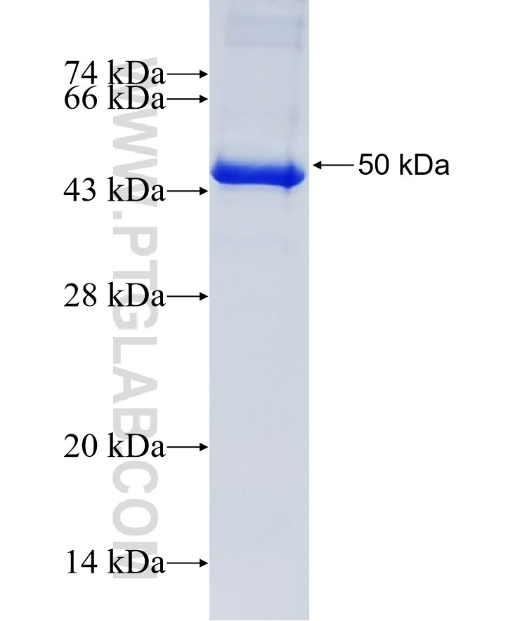 TET2 fusion protein Ag15773 SDS-PAGE