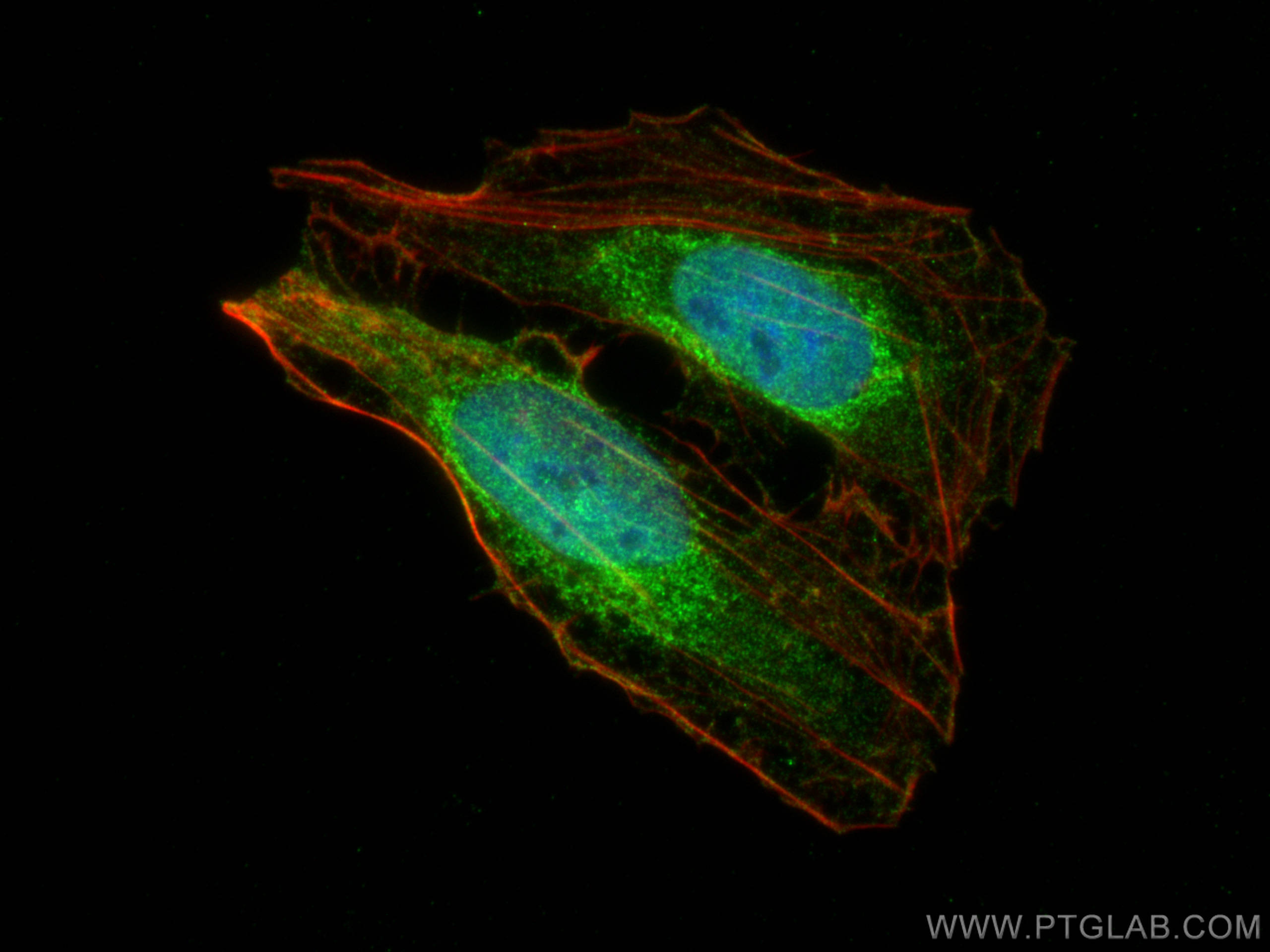 Immunofluorescence (IF) / fluorescent staining of U2OS cells using TET3 Polyclonal antibody (22612-1-AP)