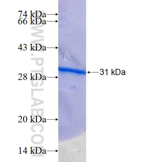 TET3 fusion protein Ag25877 SDS-PAGE