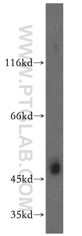 Western Blot (WB) analysis of PC-3 cells using TEX13A Polyclonal antibody (18888-1-AP)